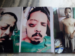 Help Mayank Fight Brain Tumor