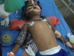 Help 4-year-old Undergo Critical Renal Transplant
