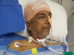 Help My Father Fight Deadly ACOM Aneurysm and Subsequent Complications