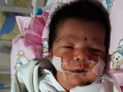 Help Baby Venice for Her Open Heart Surgery