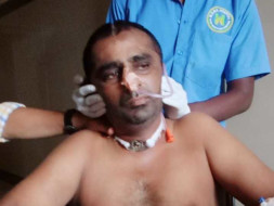 Help Jayanna for skull surgery-he is the only bread earner in family