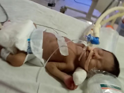 Help Baby Shafiuddin Fight Premature Birth Complications