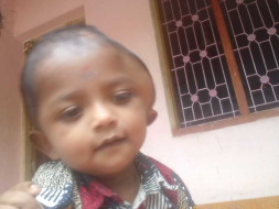 Please help 1-year-old Aromal For His Head Surgery