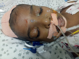 Help Ram Recover From A Critical Brain Disease