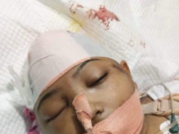 Help Us Save Swati Recover From Severe Injuries