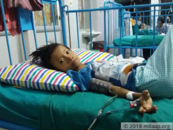 8-year-old with speech defect needs help to battle cancer