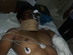 Help Lenin Recover From A Serious Accident