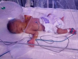 Save My 8-days-Old Premature Baby With Underdeveloped Organs