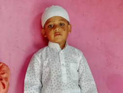 Help Our Little Ayan Undergo Bone Marrow Transplant