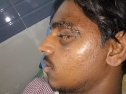 Help My Brother Recover From A Major Accident