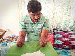 Help Vivek Get Back At Life!