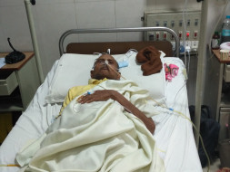 Help My Grandfather Fight Cancer & Cirrhosis