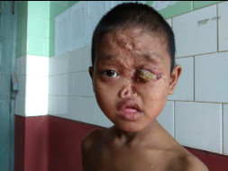 Help Niublusan Fight Against Severe Congenital Syphilis