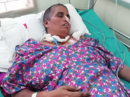 Help my wife Shyamala recover from cerebral hemorrhage