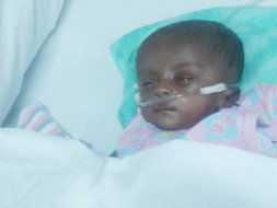 Help Little Saayishri Undergo Open Heart Surgery