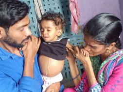 Help Baby Lucky Undergo A Liver Transplant