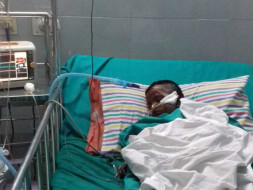 Help Baby Paerarasi Fight MRSA Septecemia Due To Burns