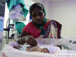 Helpless Mother Is Struggling To Save Premature Baby Born
