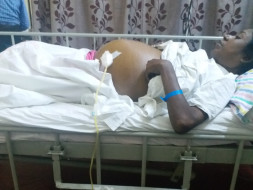 Help Purabi Ghosh for liver transplant.