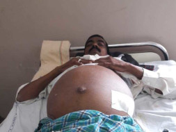 Please Help Me Raise Funds For My Father's Liver Transplantation