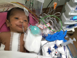 Help 1-Month-Old Baby Fight Heart Disease