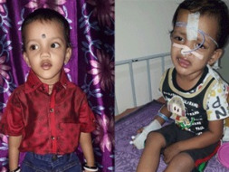Help 2-year-old Shlok Fight Eye Cancer
