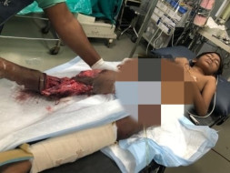 Help Little Harsha to Walk Again