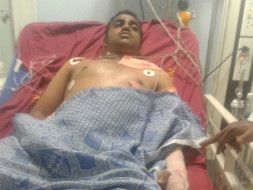 Help My Brother Recover From A Major Accident