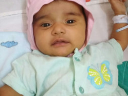 Help 1-month-old Baby Sharda Undergo A Surgery