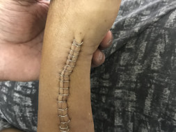 20 years of my nephew is in critical condition due to accident