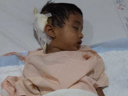 Toddler Gowrav Needs Your Help to Fight Brain Cancer