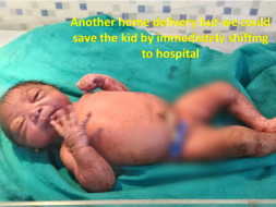 Save The Children Of 100 Villages