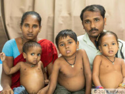 Poor Parents' All 3 Kids Have Severe Liver Disease, Need Urgent Help