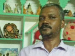 Help S. Janakiraman, Brain surgery - Endovascular Coiling