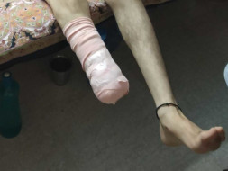 Help Ahmad Be Normal Again