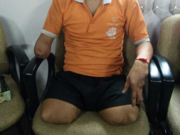 Help Suraj Walk Again