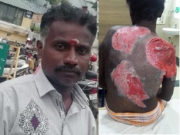 Help Manivanan Injured During Gaja Cyclone Renovation Work