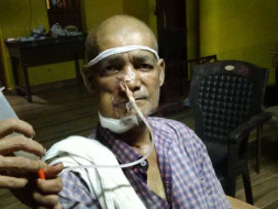 Help Shashiraj Fight Mouth Cancer