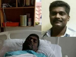 CHRONIC LIVER DISEASE (EMERGENCY LIVER TRANSPLANTATION)