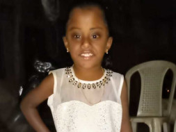 Help Shamily: Only A Surgery Can Help Her Brain To Develop
