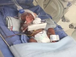 Help My Premature Baby Recover