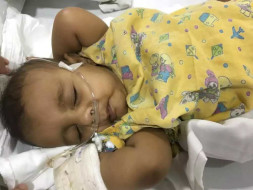Help Baby Hafiz Undergo Open Heart Surgery