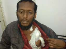 Help Zaheeruddin Undergo Fistula Surgery