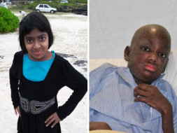 This 13-year-old Has No Friends Or A Childhood Because Of Lupus