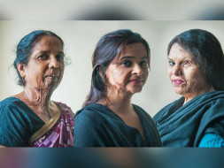 Make Love Not Scars Needs Your Support