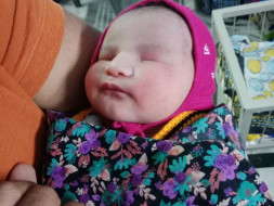 Help Restore Baby Reemi's Vision