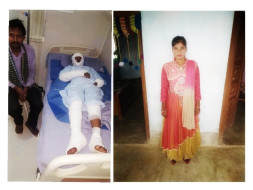Help Burn Survivor Pratima Get Married