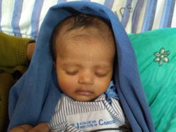 Help 4 Month Old Shravya Get Treated for 3 Holes in her Heart