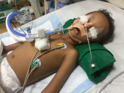 Help 3 Year Old Asad Open His Eyes