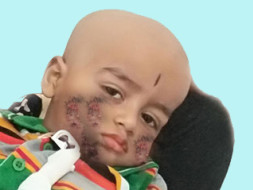 Help My Child Who Fight With His Disease To "Alive"